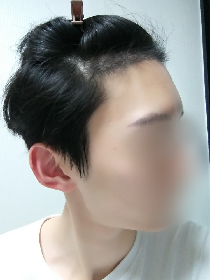 01.수술네달.jpg