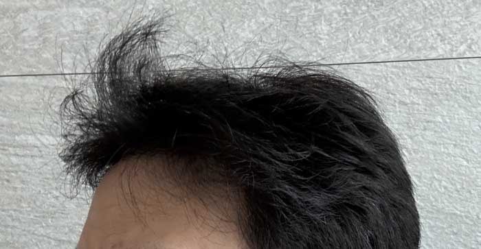 옆모습도봐줄만해짐.jpg