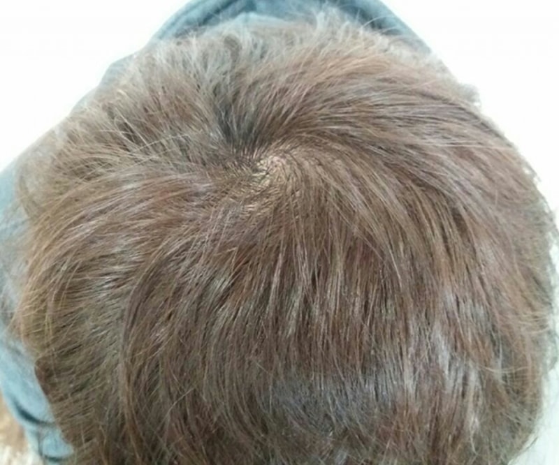 5개월.jpg