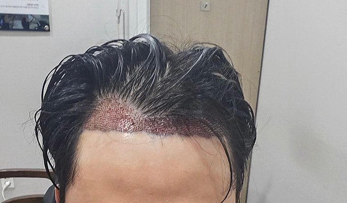 포토후기 이미지