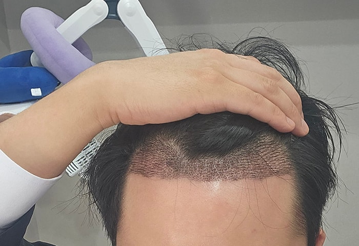 3- 11-17 오늘 찍은 사진.jpg