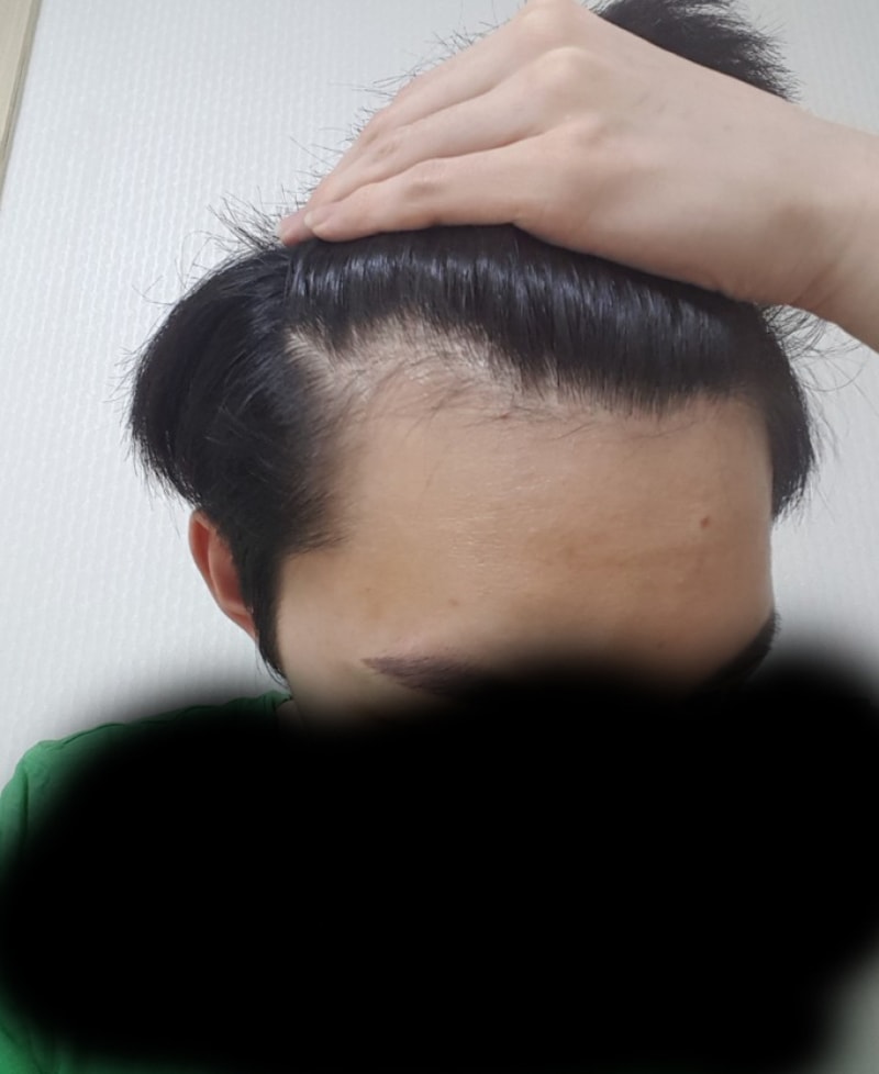 M-shaped cut 2000 Mo review