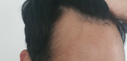 수술전ㅠㅠ.jpg