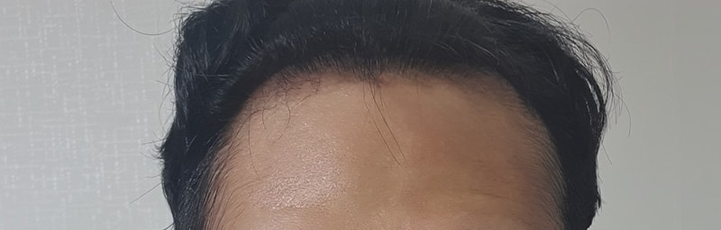 후2.jpg