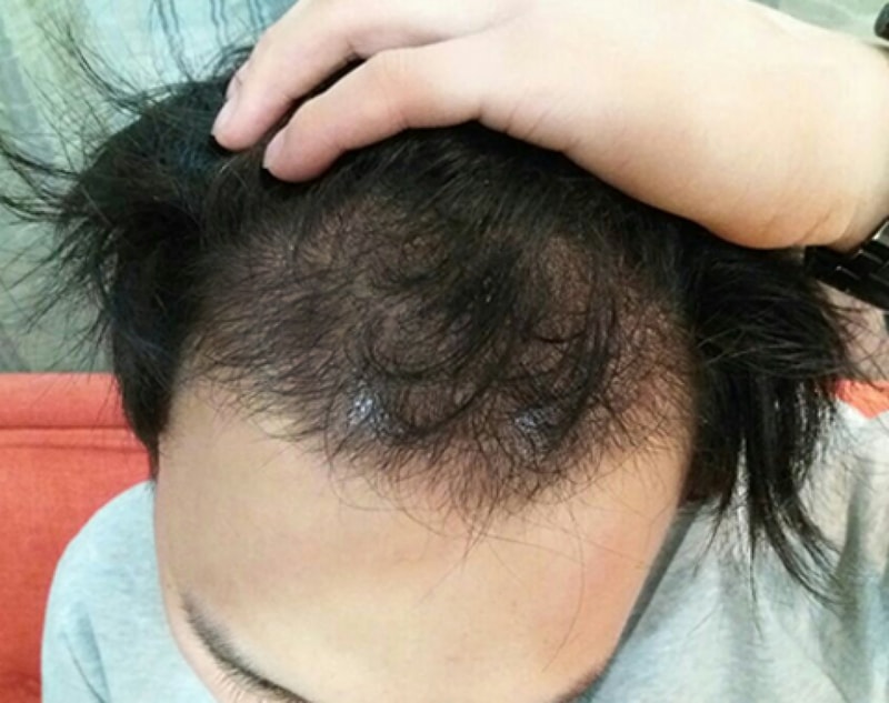 후2.jpg