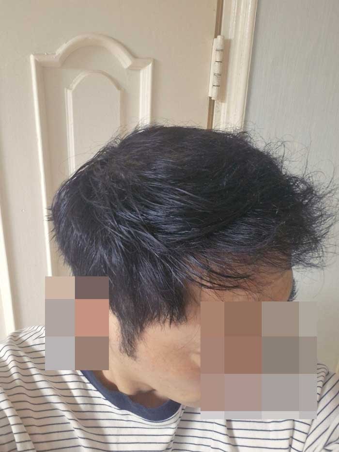 우측면.jpg