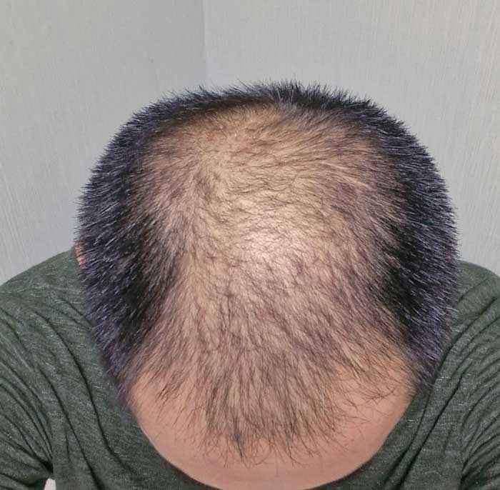 z.jpg