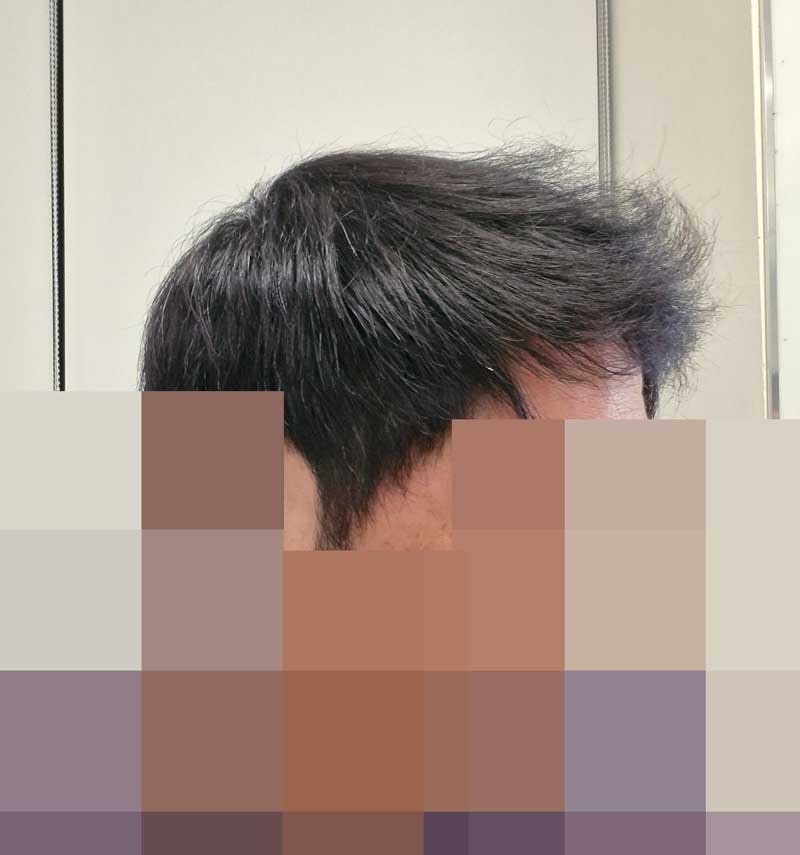 11개월많이변했다.jpg