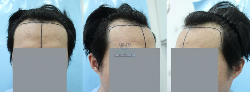 3ec6b468a4d5a8915a6a3157bc38a101.png