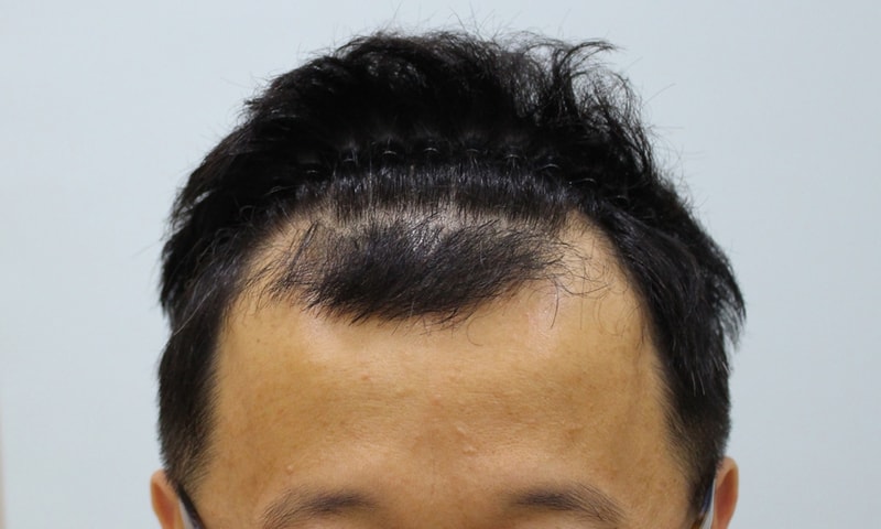 01.jpg