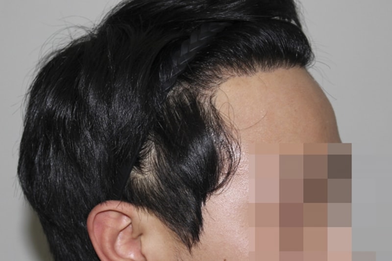수술후_03.jpg