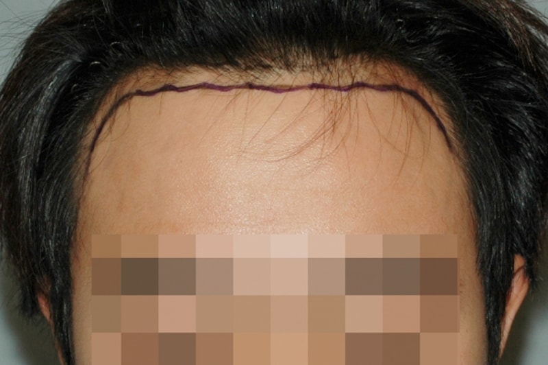 수술전_04.jpg