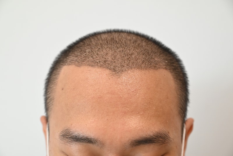 2주 경과.jpg