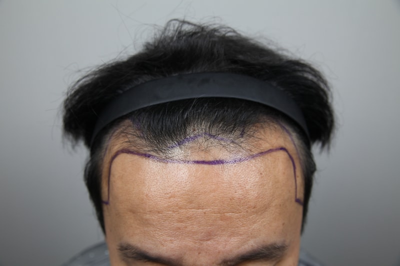 믿고 그냥하세요. 만족하실겁니다.