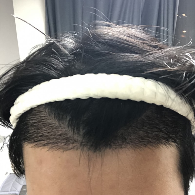 광주 압구정모비앙 2주차 경과 후기 사진.jpeg