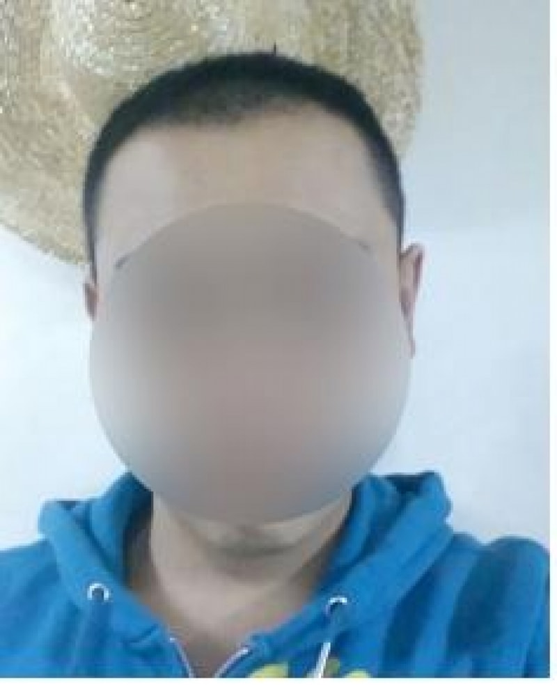 자신감 상승중!!!! 다나 성형외과에서 비절개 모발이식 2900모낭 두달차입니다 ㅋ