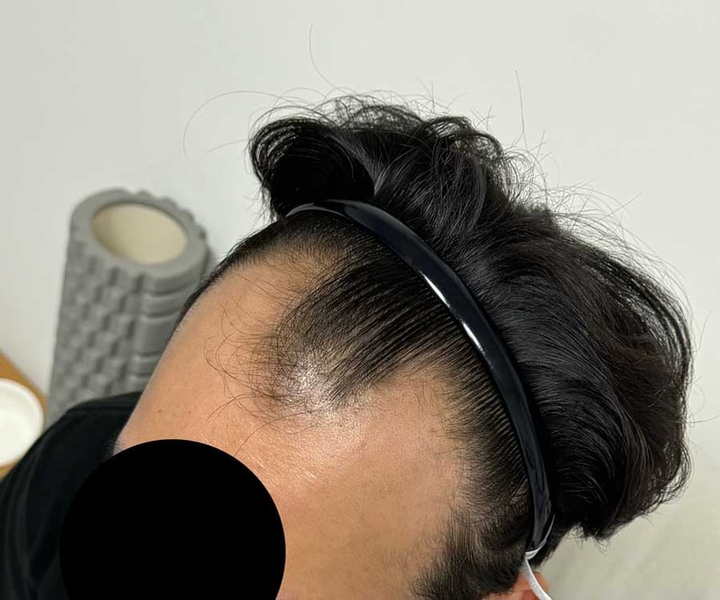 전_11개월전.jpg