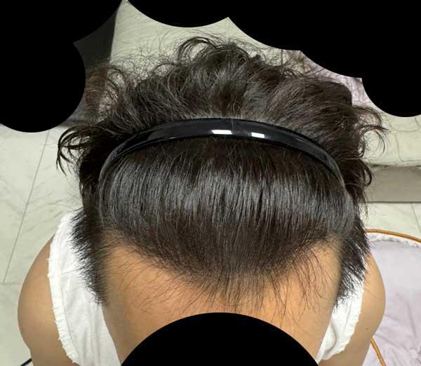 1년차정면.jpg