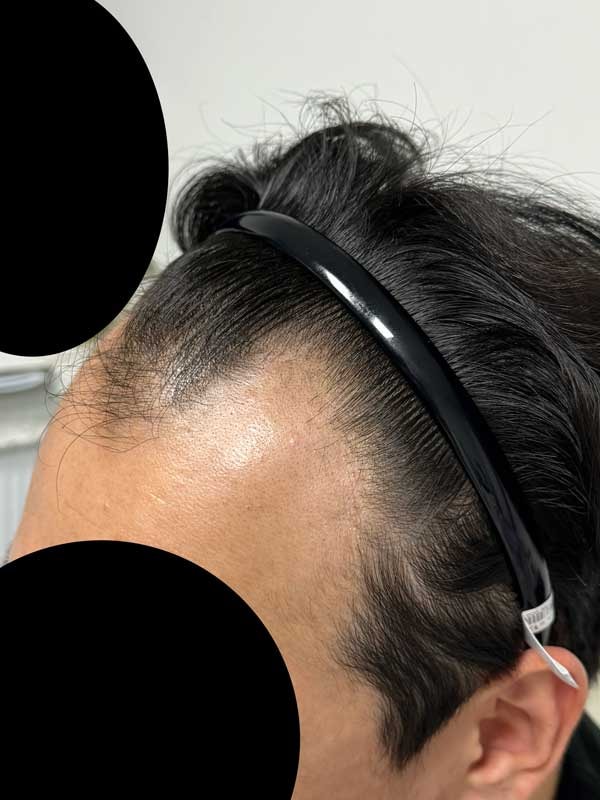 수술전 진짜심각.jpg