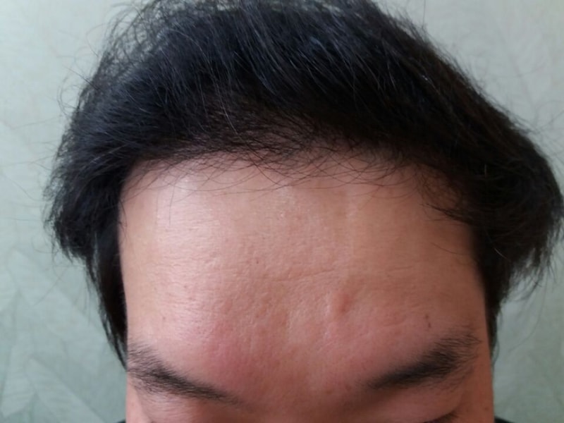 수술후3.jpg