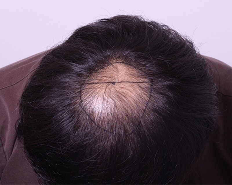 수술전1.jpg