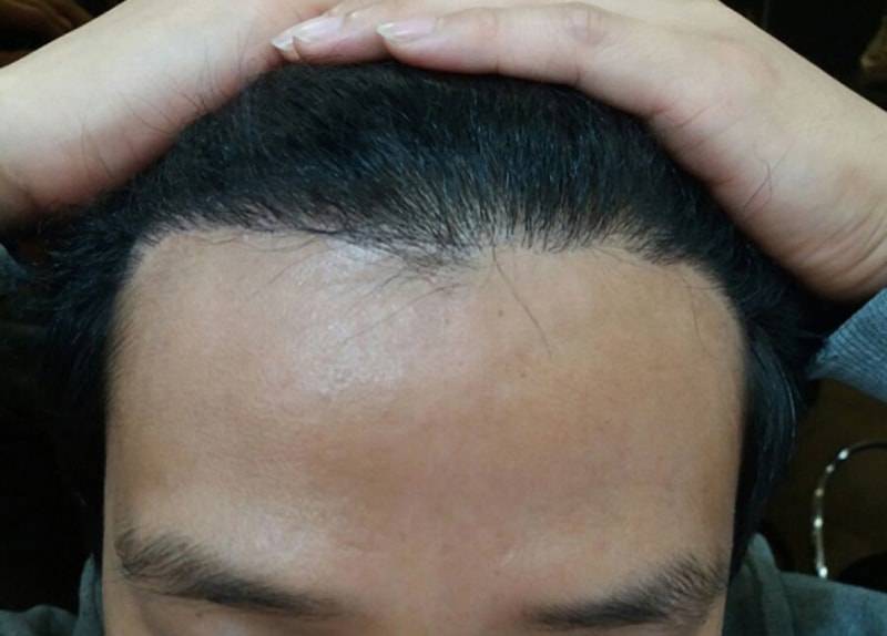 후2.jpg