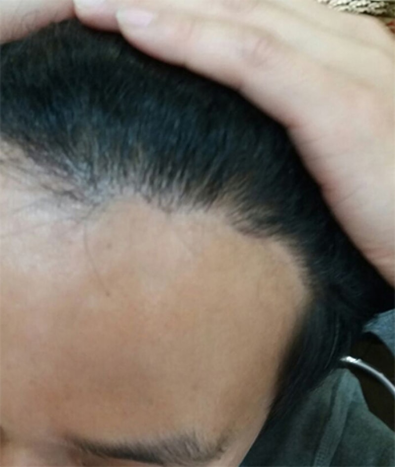 후1.jpg