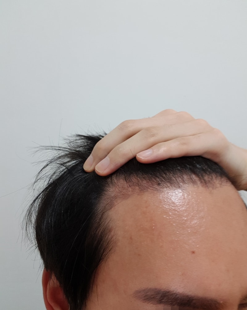 暗黒期は終わったのでしょうか？