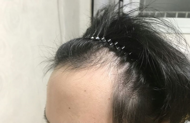 KakaoTalk_Moim_5SdY6oNQM40iDChWzJzUevRrQtg8z8.jpg