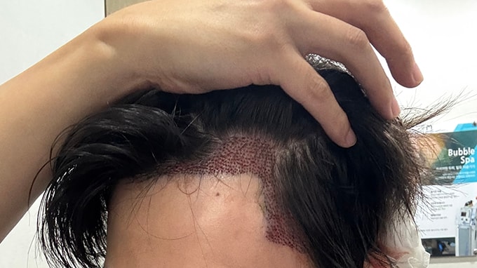 4. 비어있던 곳에 이식모들이 보이니 뿌듯합니다.jpg