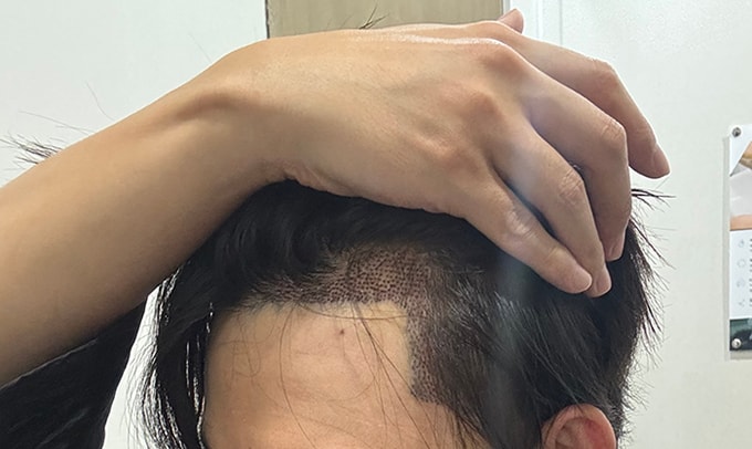 6. 랩 두르고 비니 쓴 상태로 잠을 자서 찝찝했는데 샴푸받으니 시원합니다.jpg