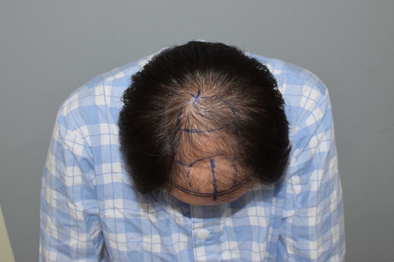 수술전2.JPG