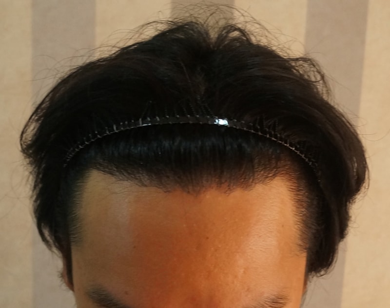 후1.jpg