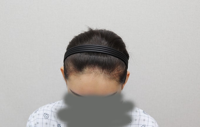수술전2.jpg