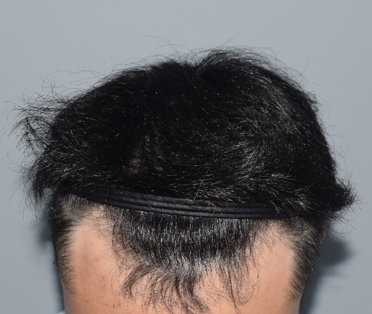 1.JPG