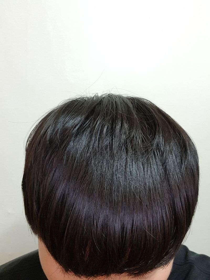 06.수술2일차.jpg