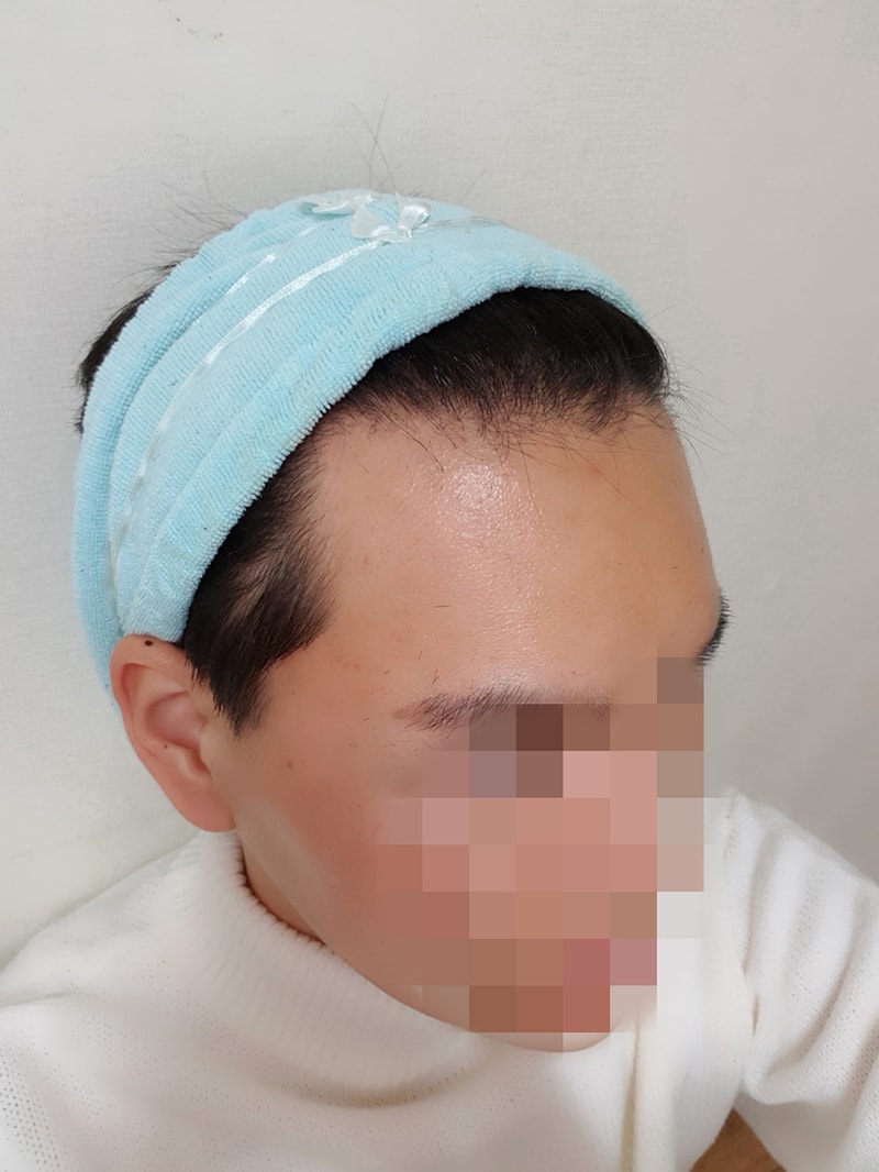 03.수술전.jpg