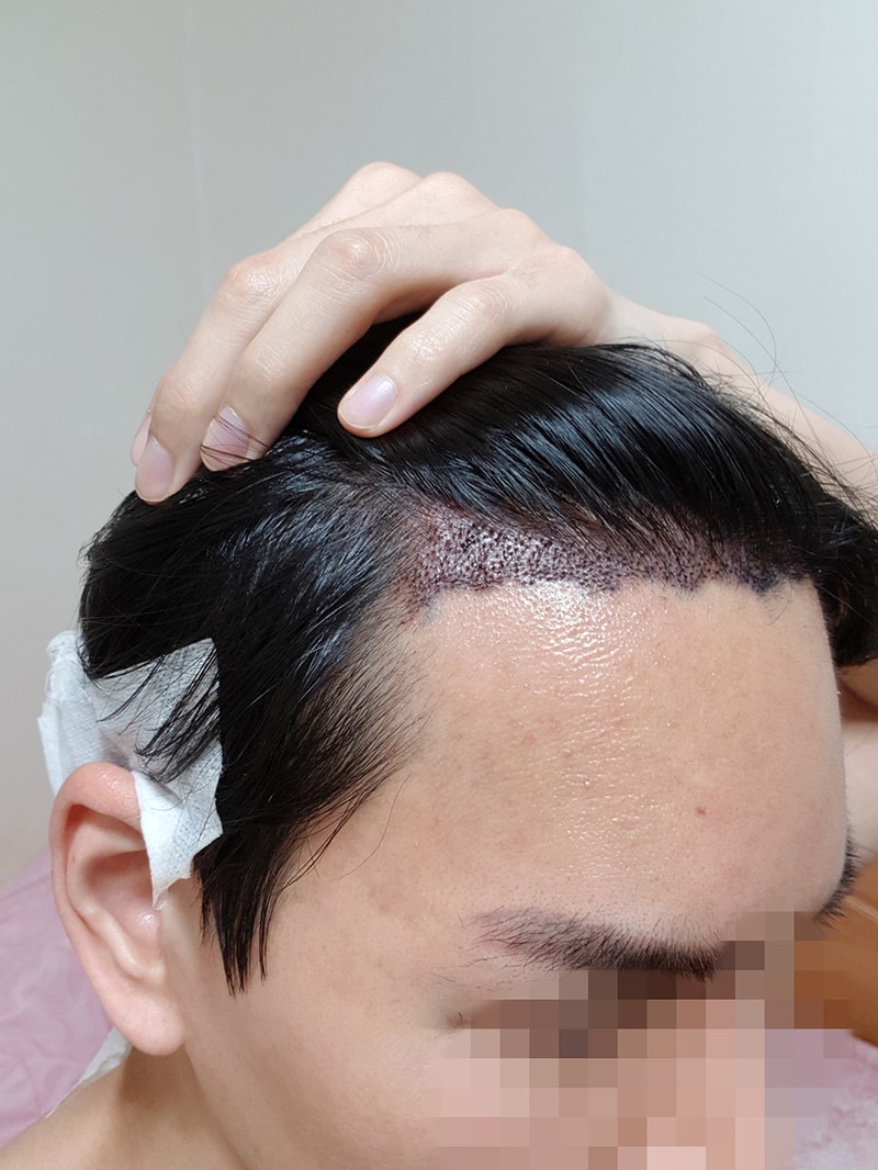 05.수술1일.jpg