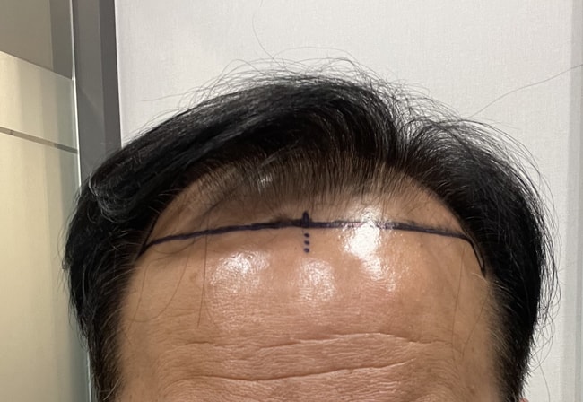 수술전휑하다.jpg