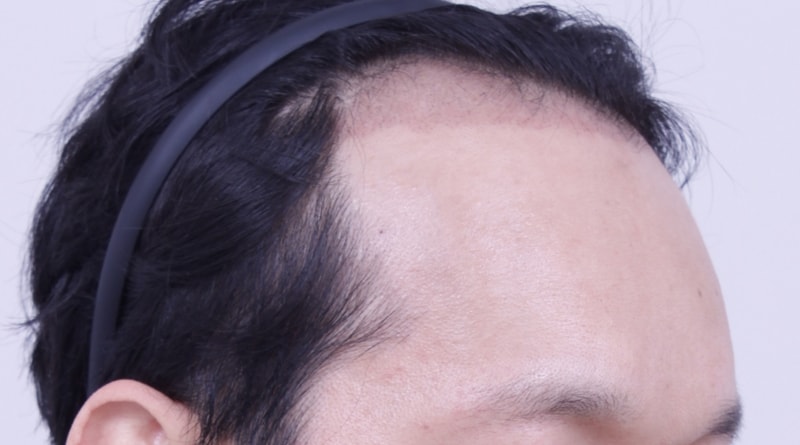 3주2.JPG
