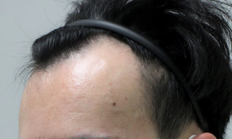 06.수술전.JPG