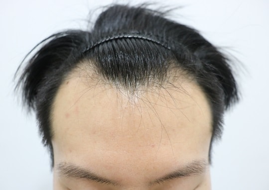 MOST 3000MO 1年后期