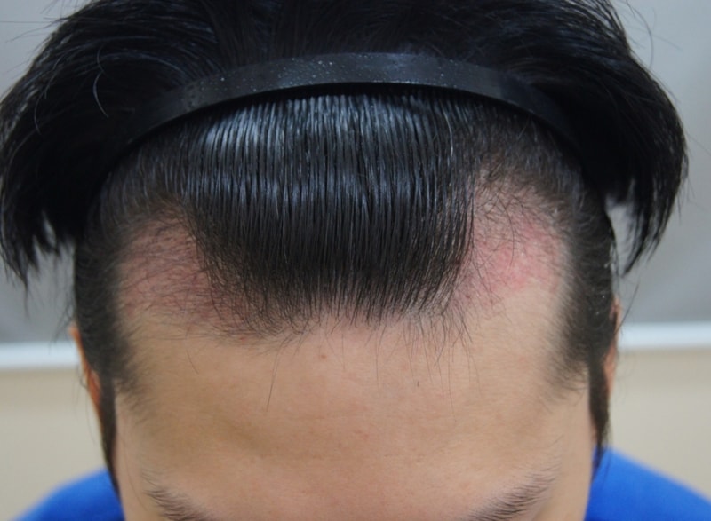 3주2.JPG