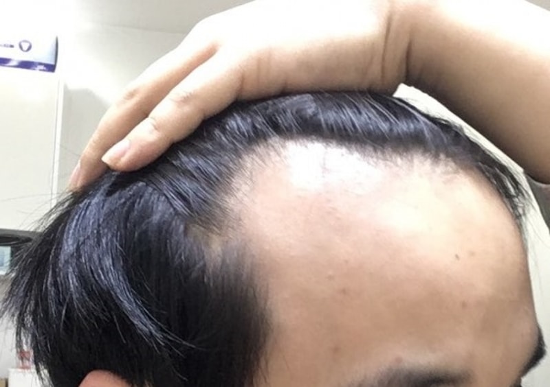 KakaoTalk_20161102_101005881.jpg