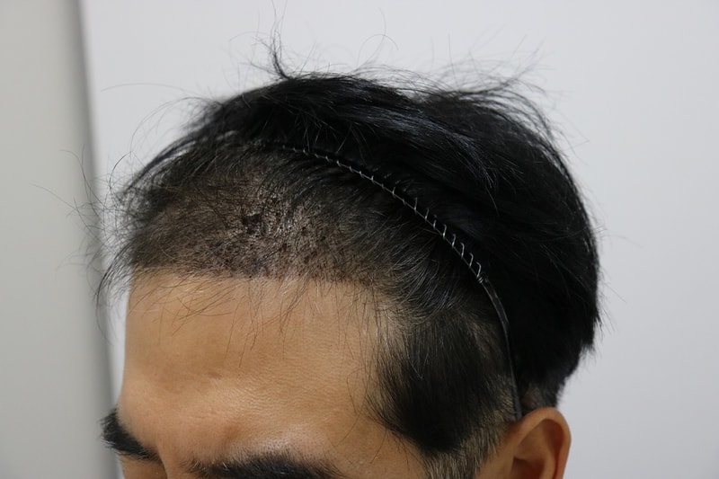 옆.jpg
