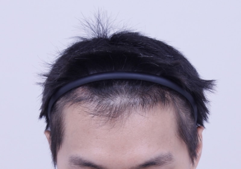크기변환_4개월_정면.jpg