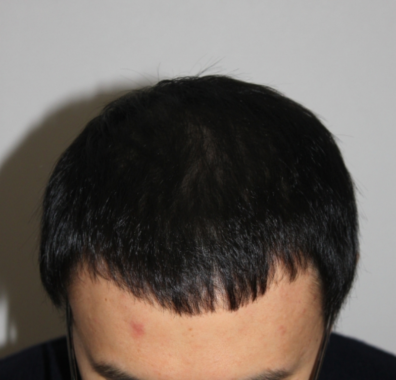 20150211_110632.png