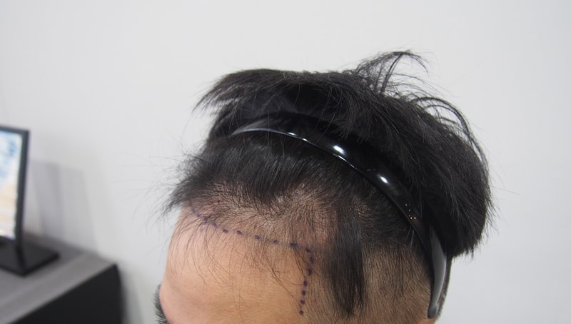 좌옆전.jpg