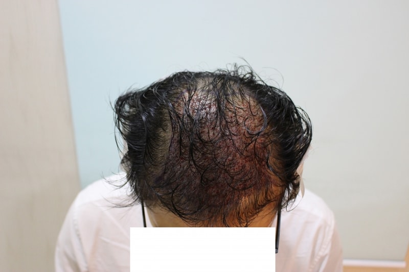 수술당일1.jpg