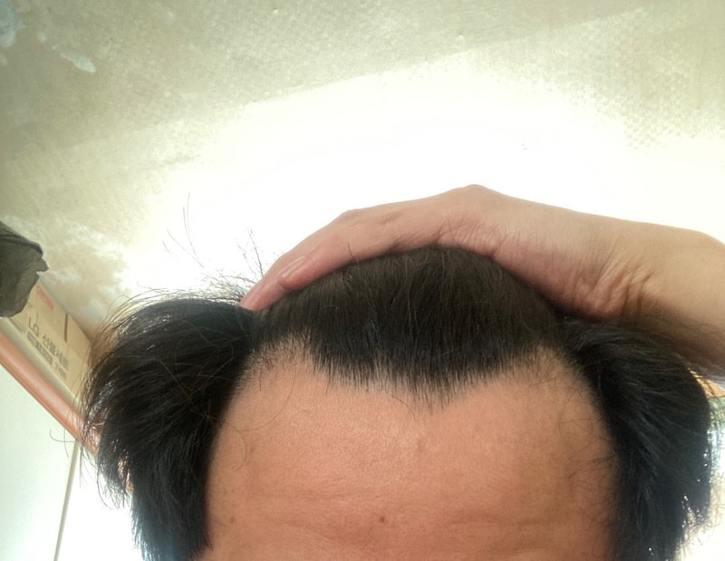 丸刈り9か月